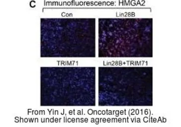 Anti-HMGA2 antibody - ChIP grade used in Immunocytochemistry/ Immunofluorescence (ICC/IF). GTX100519