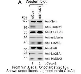 Anti-HMGA2 antibody - ChIP grade used in Western Blot (WB). GTX100519