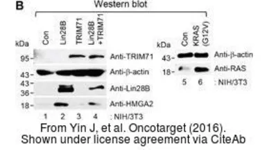 Anti-HMGA2 antibody - ChIP grade used in Western Blot (WB). GTX100519