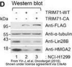 Anti-HMGA2 antibody - ChIP grade used in Western Blot (WB). GTX100519