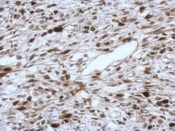 Anti-HMGA2 antibody - ChIP grade used in IHC (Paraffin sections) (IHC-P). GTX100519