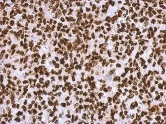 Anti-HMGA2 antibody - ChIP grade used in IHC (Paraffin sections) (IHC-P). GTX100519