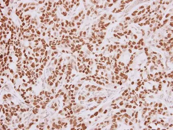 Anti-HMGA2 antibody - ChIP grade used in IHC (Paraffin sections) (IHC-P). GTX100519