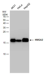 Anti-HMGA2 antibody - ChIP grade used in Western Blot (WB). GTX100519