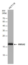 Anti-HMGA2 antibody - ChIP grade used in Western Blot (WB). GTX100519