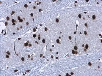 Anti-HMGA2 antibody - ChIP grade used in IHC (Paraffin sections) (IHC-P). GTX100519