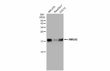 Anti-HMGA2 antibody - ChIP grade used in Western Blot (WB). GTX100519