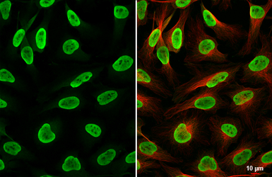 Anti-HMGA2 antibody - ChIP grade used in Immunocytochemistry/ Immunofluorescence (ICC/IF). GTX100519