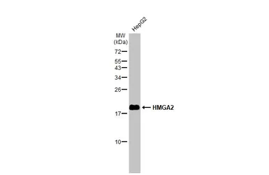 Anti-HMGA2 antibody - ChIP grade used in Western Blot (WB). GTX100519