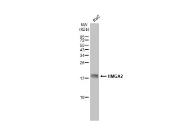 Anti-HMGA2 antibody - ChIP grade used in Western Blot (WB). GTX100519