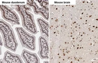 Anti-HMGA2 antibody - ChIP grade used in IHC (Paraffin sections) (IHC-P). GTX100519