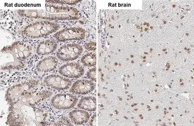 Anti-HMGA2 antibody - ChIP grade used in IHC (Paraffin sections) (IHC-P). GTX100519