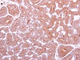 Anti-IGF1 antibody used in IHC (Paraffin sections) (IHC-P). GTX100521