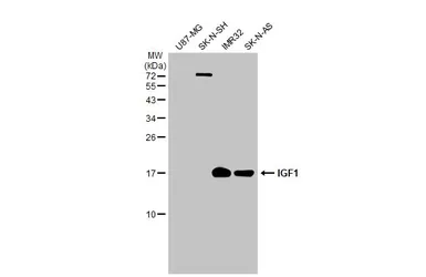 Anti-IGF1 antibody used in Western Blot (WB). GTX100521