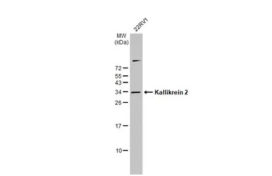 Anti-Kallikrein 2 antibody [N3C3] used in Western Blot (WB). GTX100526