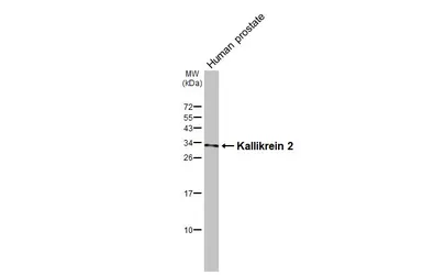 Anti-Kallikrein 2 antibody [N3C3] used in Western Blot (WB). GTX100526