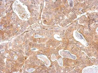 Anti-Kallikrein 2 antibody [N3C3] used in IHC (Paraffin sections) (IHC-P). GTX100526