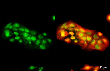 Anti-MDM2 antibody used in Immunocytochemistry/ Immunofluorescence (ICC/IF). GTX100531