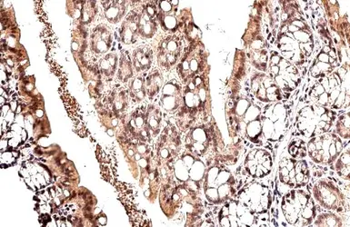 Anti-MDM2 antibody used in IHC (Paraffin sections) (IHC-P). GTX100531