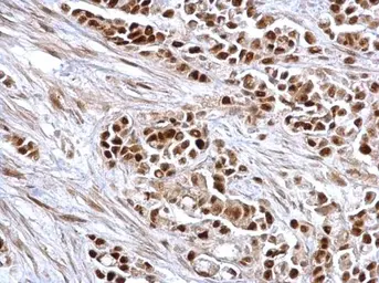 Anti-Rb antibody used in IHC (Paraffin sections) (IHC-P). GTX100545