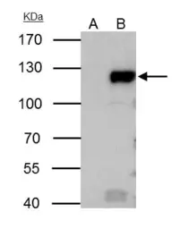 Anti-Rb antibody used in Immunoprecipitation (IP). GTX100545