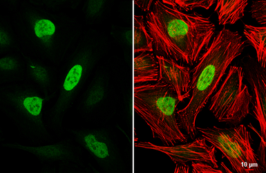 Anti-Rb antibody used in Immunocytochemistry/ Immunofluorescence (ICC/IF). GTX100545