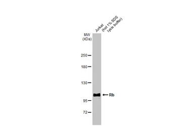 Anti-Rb antibody used in Western Blot (WB). GTX100545