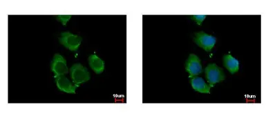 Anti-RhoC antibody used in Immunocytochemistry/ Immunofluorescence (ICC/IF). GTX100546