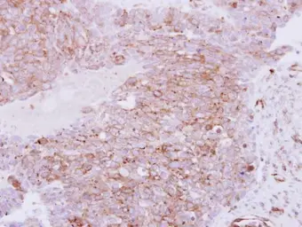 Anti-RhoC antibody used in IHC (Paraffin sections) (IHC-P). GTX100546