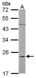 Anti-RhoC antibody used in Western Blot (WB). GTX100546