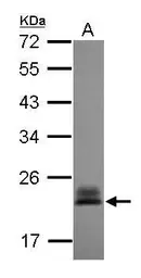 Anti-RhoC antibody used in Western Blot (WB). GTX100546