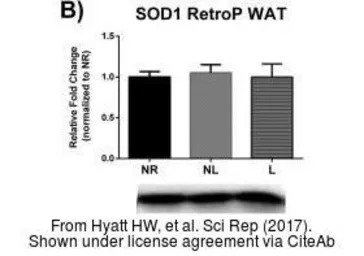 Anti-SOD1 antibody used in Western Blot (WB). GTX100554