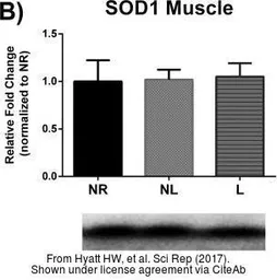 Anti-SOD1 antibody used in Western Blot (WB). GTX100554