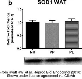 Anti-SOD1 antibody used in Western Blot (WB). GTX100554