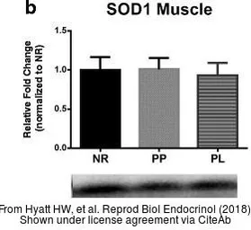 Anti-SOD1 antibody used in Western Blot (WB). GTX100554