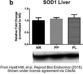 Anti-SOD1 antibody used in Western Blot (WB). GTX100554