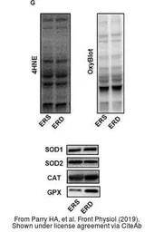 Anti-SOD1 antibody used in Western Blot (WB). GTX100554