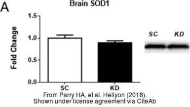 Anti-SOD1 antibody used in Western Blot (WB). GTX100554