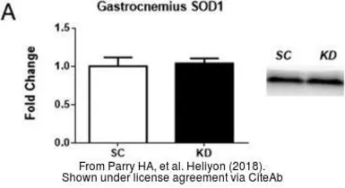 Anti-SOD1 antibody used in Western Blot (WB). GTX100554