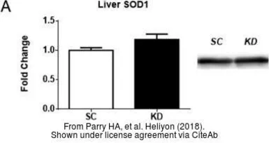 Anti-SOD1 antibody used in Western Blot (WB). GTX100554