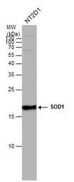 Anti-SOD1 antibody used in Western Blot (WB). GTX100554