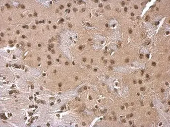 Anti-SOD1 antibody used in IHC (Paraffin sections) (IHC-P). GTX100554