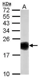 Anti-SOD1 antibody used in Western Blot (WB). GTX100554