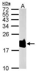 Anti-SOD1 antibody used in Western Blot (WB). GTX100554