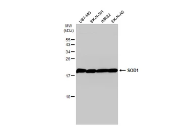 Anti-SOD1 antibody used in Western Blot (WB). GTX100554