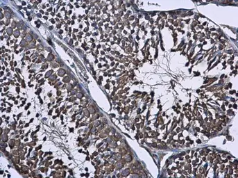 Anti-Wilms Tumor 1 antibody used in IHC (Paraffin sections) (IHC-P). GTX100563