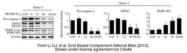 Anti-PARP antibody used in Western Blot (WB). GTX100573