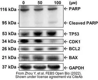 Anti-PARP antibody used in Western Blot (WB). GTX100573