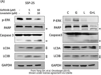 Anti-PARP antibody used in Western Blot (WB). GTX100573