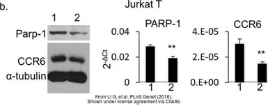 Anti-PARP antibody used in Western Blot (WB). GTX100573